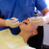 Wisdom Tooth Removal