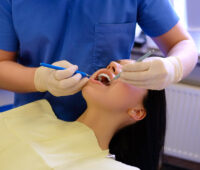 Wisdom Tooth Removal