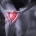 Knee ligament pain
